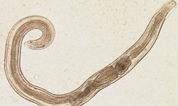 Enterobius vermicularis